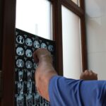 Proyectopodría beneficiar a más de 90 millones al facilitar intercambio de tomografías y radiografías entre hospitales